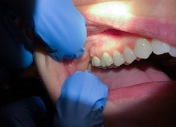Best Orthodontic Emergency Dentist in Jamesport, NY